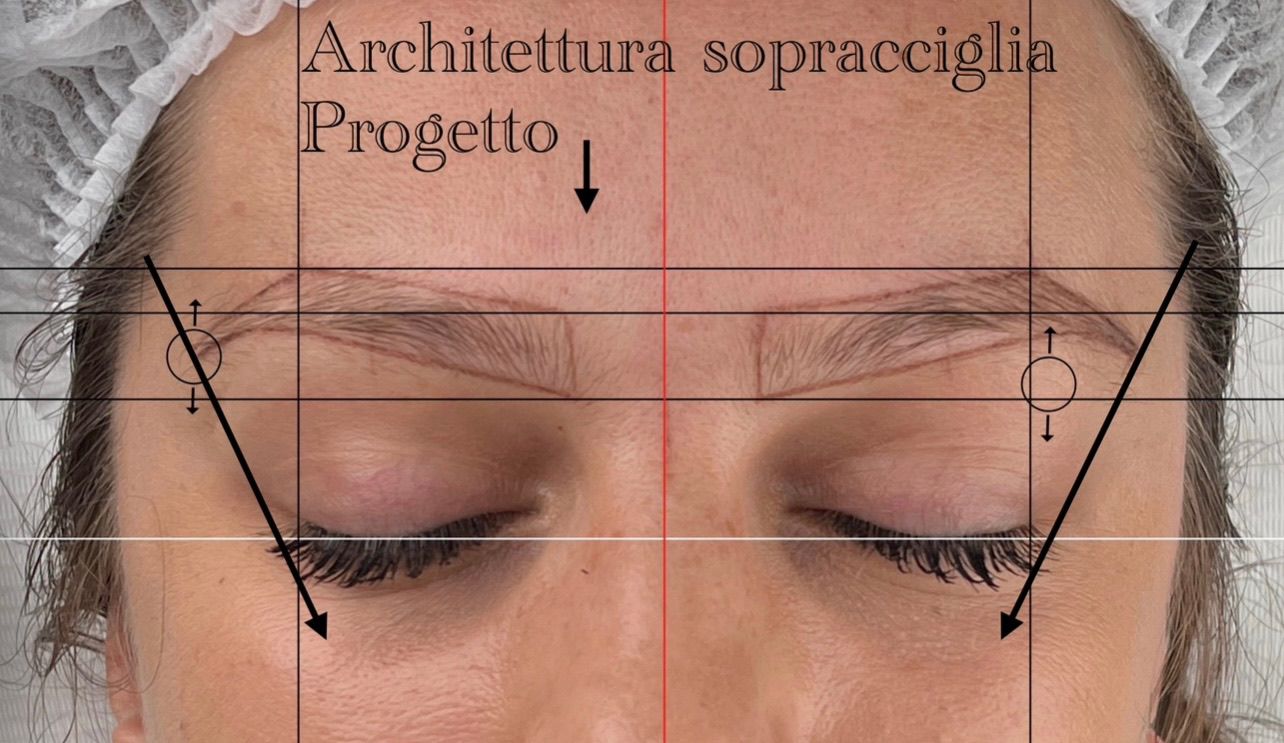 Progetto su misura simulazione sopracciglia prima del trattamento